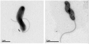 Bacterie M. promoryiensis onder de elektronenmicroscoop. Bron | Dylan Atkins