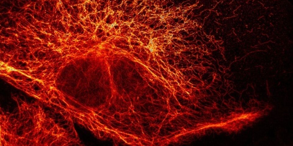 Photograph: Stefan W Hell/Division of Optical Nanoscopy/German Cancer Research Center